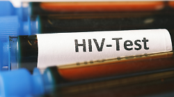 Crescono i casi di Hiv in Italia, l'incidenza di nuove diagnosi in Umbria è la seconda del Paese. I dati dell'Iss
