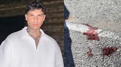 Accoltellato al collo, caccia all'assassino. Gli amici lo hanno visto