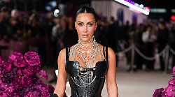Kim Kardashian rivela di avere un'aneurisma cerebrale: "Quando ero sposata con Kanye West  soffrivo di psoriasi. Ora è tornata". Com'è oggi il rapporto l'ex marito 