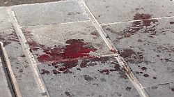 Tracce di sangue in piazza della Repubblica e al quadrivio: indaga la polizia 