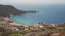 Si ferisce a un dito sull'isola e resta ore senza cure: la denuncia di un cittadino