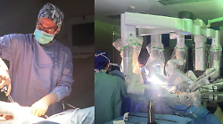 Rimosso con il robot un fibroma uterino di quasi 2 chili: 41enne operata con successo all'ospedale di Perugia 