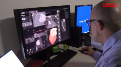 Salute, alla prevenzione il 5% della spesa sanitaria: il rapporto