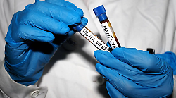 Hantavirus, dall&rsquo;influenza ai problemi respiratori: come riconoscere i sintomi