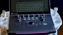 Perugia, nuovo ecocardiografo all&rsquo;avanguardia: la Cardiologia punta su diagnostica 4D e intelligenza artificiale