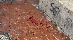 Episodio violento alla stazione: giovane ferito in ospedale