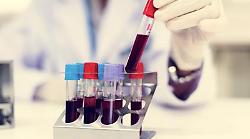 Nuovo tipo di diabete giovanile scoperto in Africa, la conferma che cambia la storia in un maxi studio