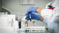 Infezioni respiratorie, studio evidenzia impatto metapneumovirus su anziani