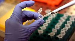 Farmaci, anticorpo monoclonale possibile scudo contro batterio Shigella