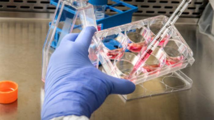 Virus Oropouche si trasmette col sesso: ecco sintomi e cure. In Italia 5 casi importanti