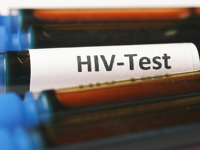 Crescono i casi di Hiv in Italia, l'incidenza di nuove diagnosi in Umbria è la seconda in Italia. I dati dell'Iss