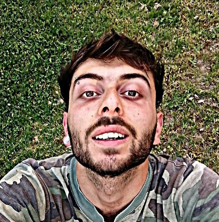 ragazzo morto baschi roma