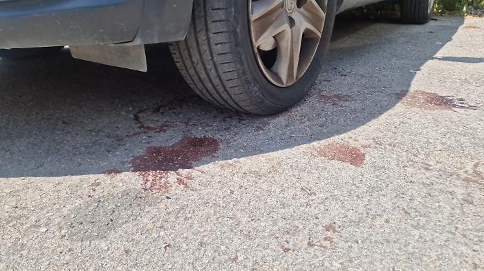 Accoltellato da un  branco di uomini in un parcheggio: gli hanno amputato un dito con una katana 