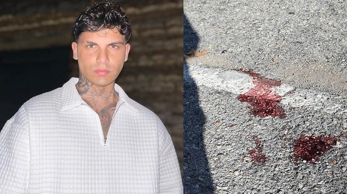 Accoltellato al collo, caccia all'assassino. Gli amici lo hanno visto