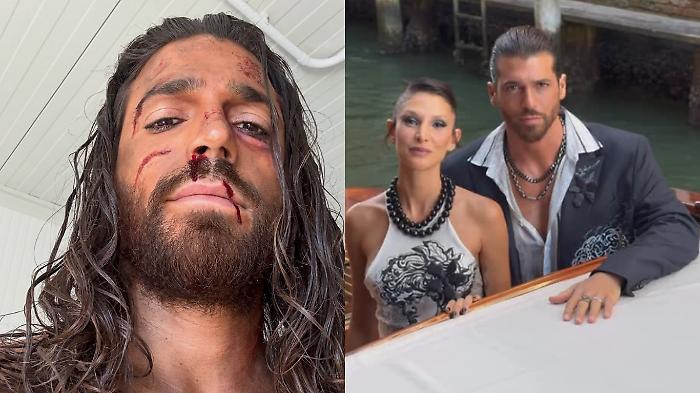 Can Yaman, dall'amore con Sara Bluma al profilo Instagram sparito. Scopri tutto sull'attore che interpreta Sandokan