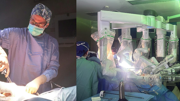 Rimosso con il robot un fibroma uterino di quasi 2 chili: 41enne operata con successo all'ospedale di Perugia 