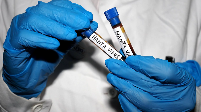 Hantavirus, dall&rsquo;influenza ai problemi respiratori: come riconoscere i sintomi