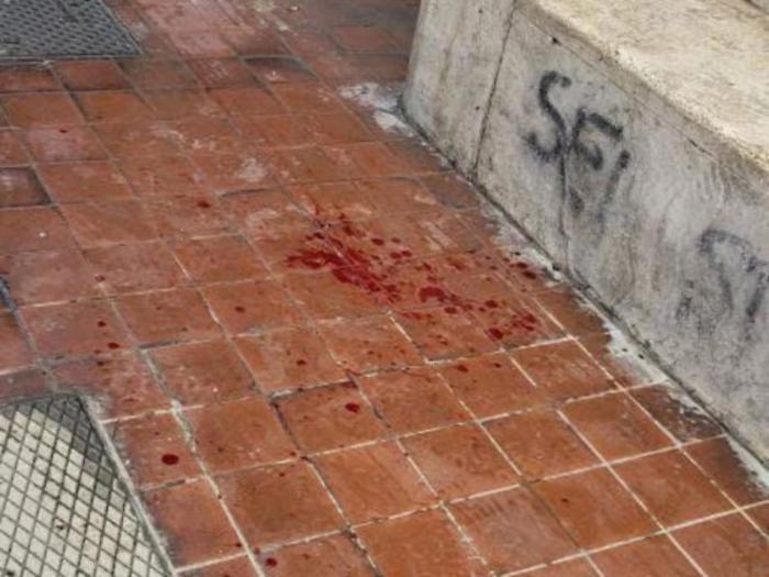 Episodio violento alla stazione: giovane ferito in ospedale