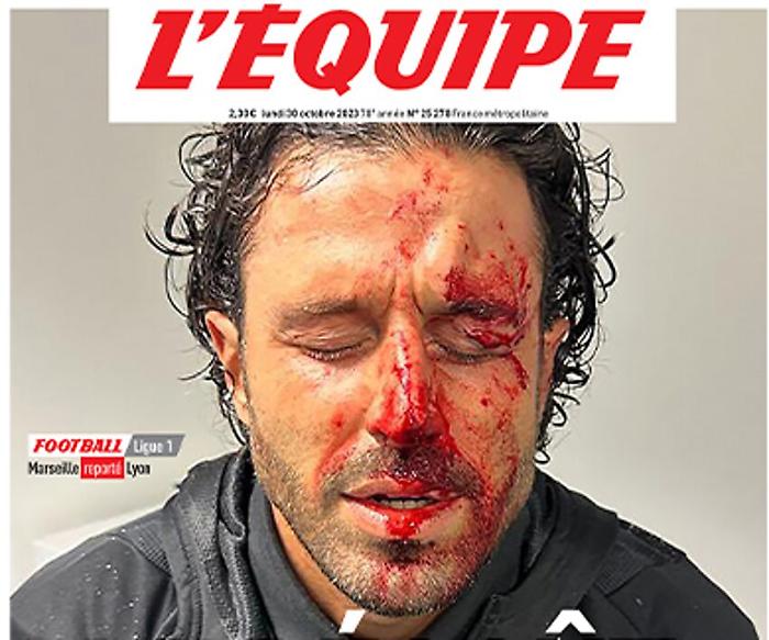 Fabio Grosso, l'ex giocatore del Perugia ferito nell'assalto al pullman del Lione: ferito e sangue